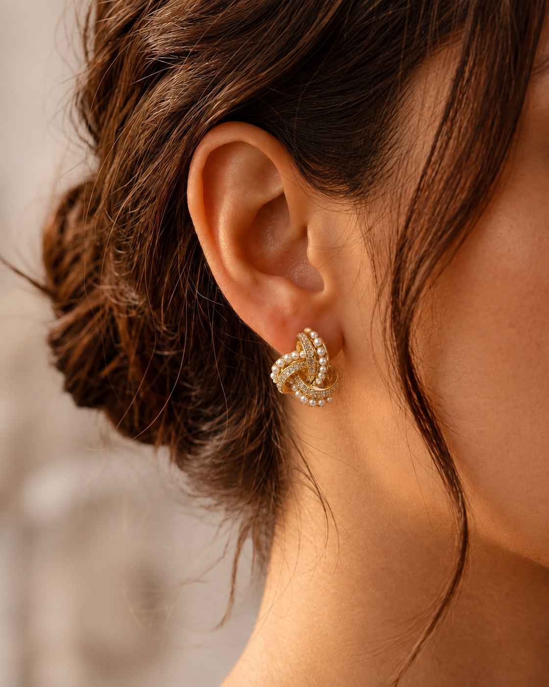 aretes aretes