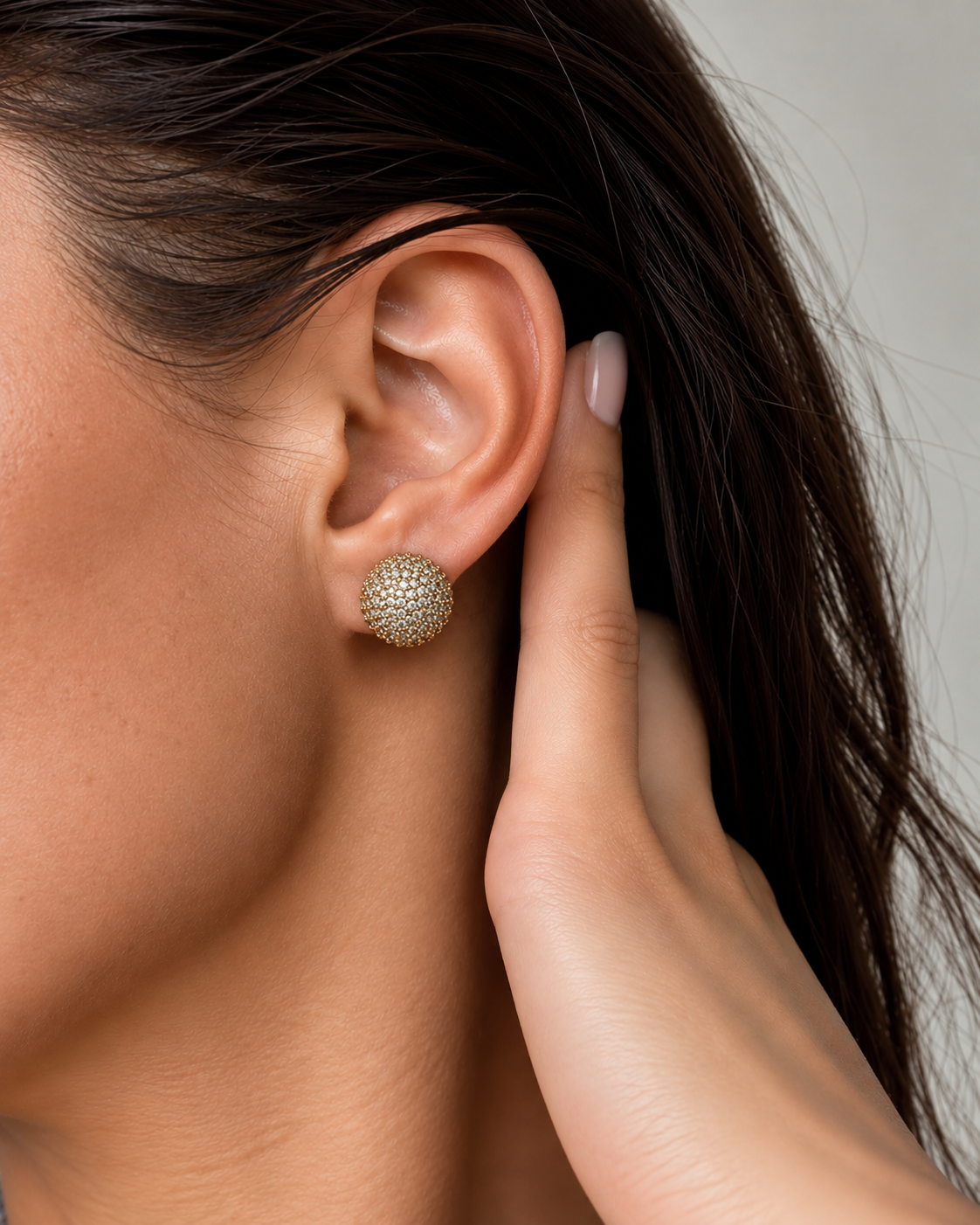 aretes aretes