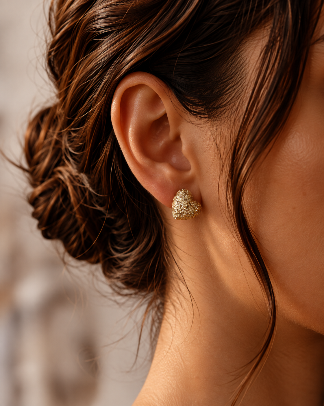 aretes aretes