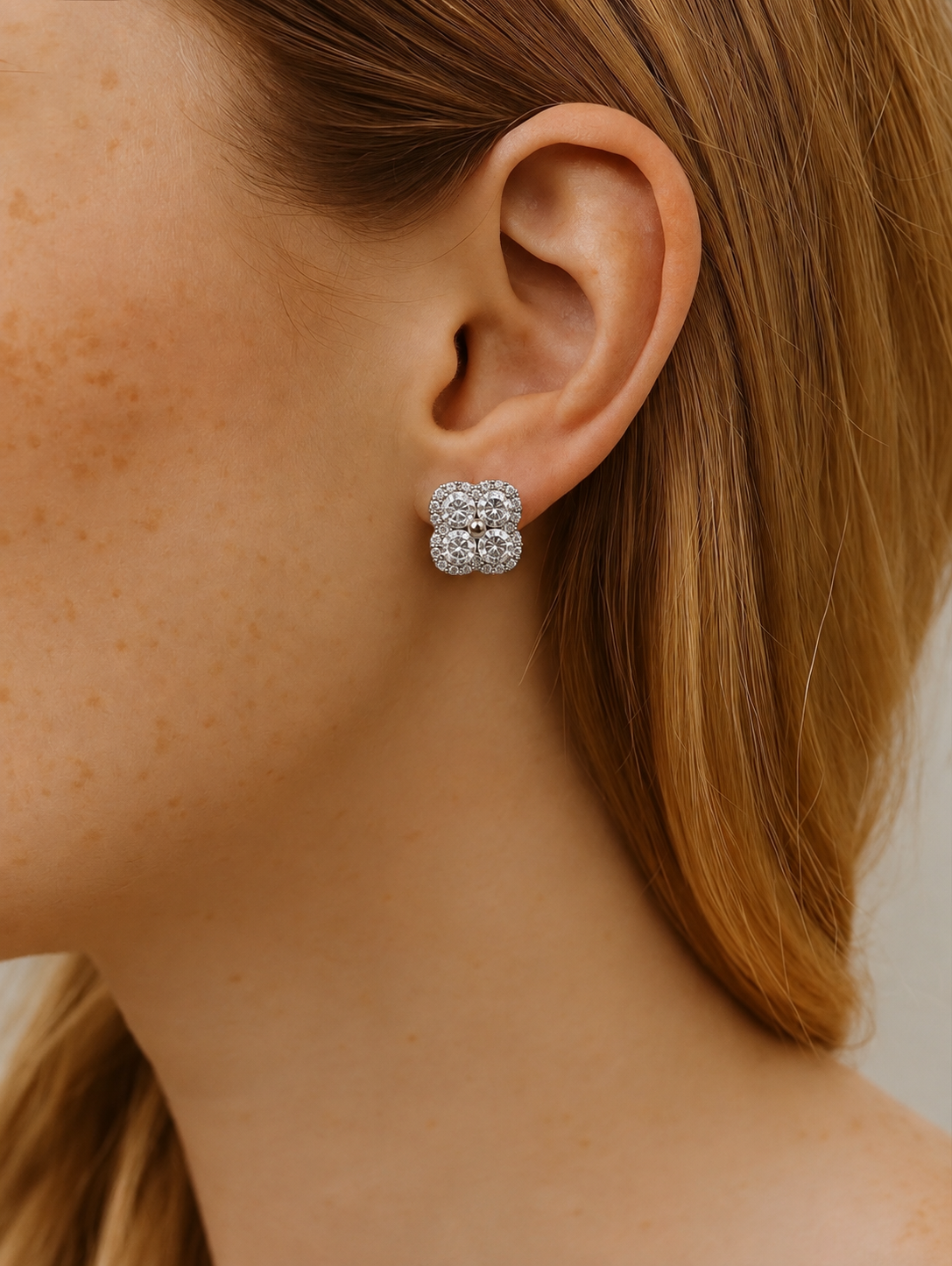 aretes aretes